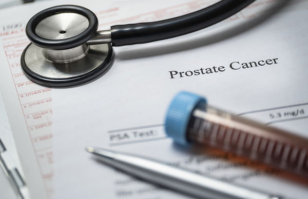 You are currently viewing Some men whose prostate cancer progresses can safely delay treatment